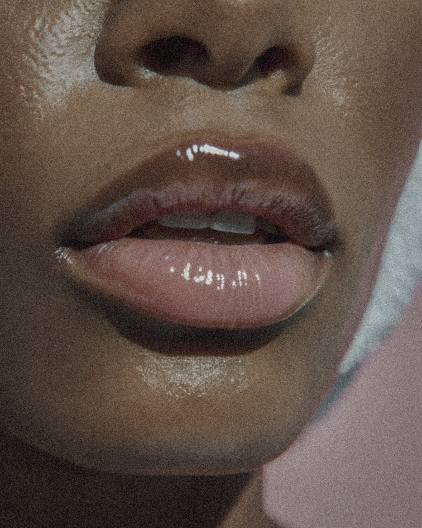Close-up of glossy lips — Skin! Medical Aesthetics, Denver