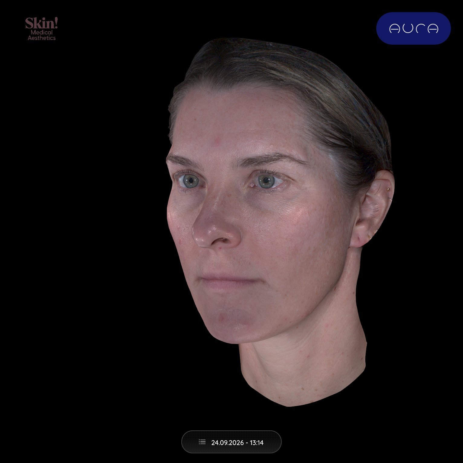 Aura Reality 3D model of a patient’s face and neck, three-quarter view