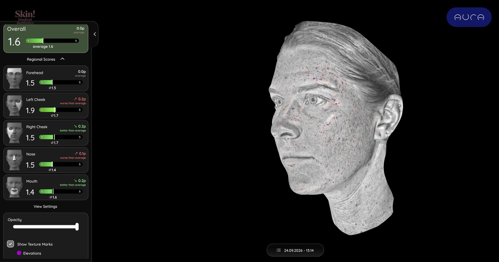Aura texture view in grayscale with surface irregularities marked across the face