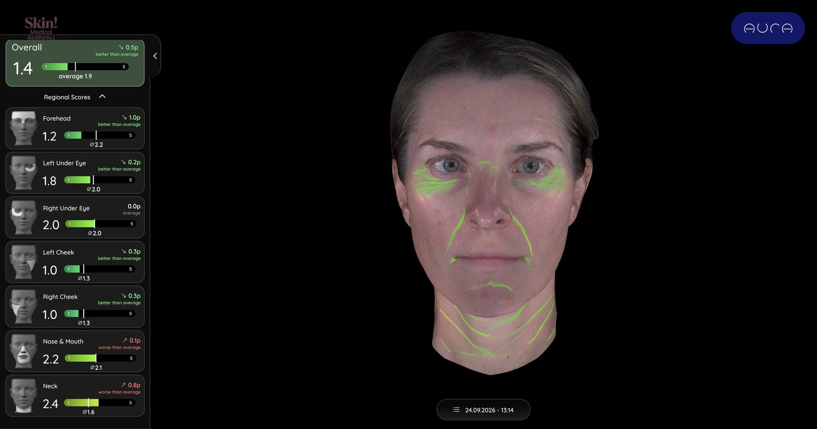 Aura line analysis with fine lines mapped in green across the forehead, under-eyes, smile lines, and neck