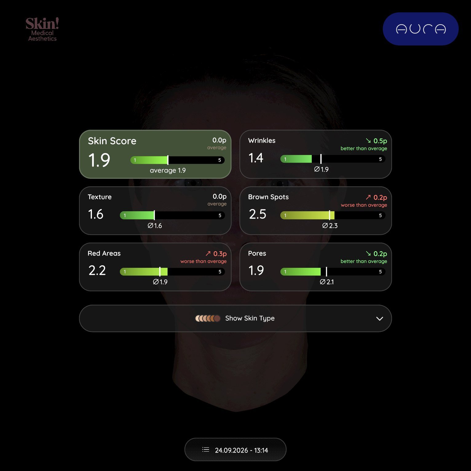 Aura summary screen with scores for overall skin, wrinkles, texture, brown spots, red areas, and pores